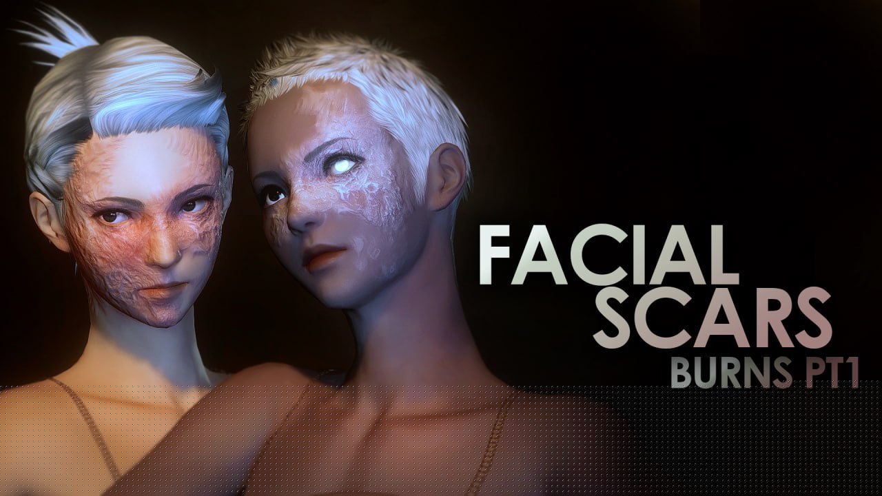 Facial Scars - Burns - PT 1
